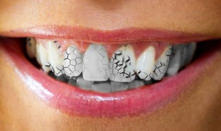 夢見牙齒代表什麼意思？為什麼會夢到牙齒？