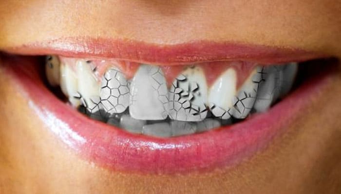 夢見牙齒代表什麼意思？為什麼會夢到牙齒？