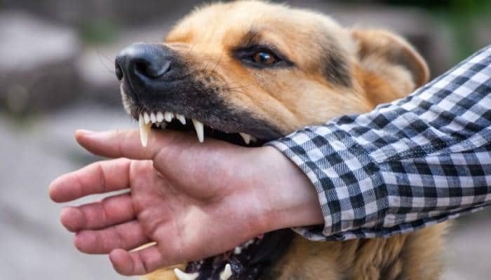 夢見咬人代表什麼意思？為什麼會夢到咬人？